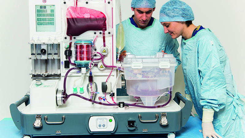Organox Metra With Surgeons