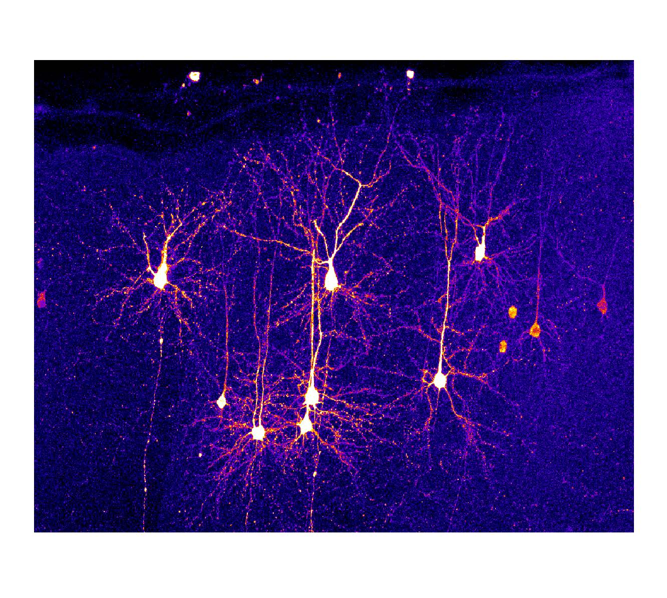 Sparse Gcamp6f Labelling In Motor Cortex