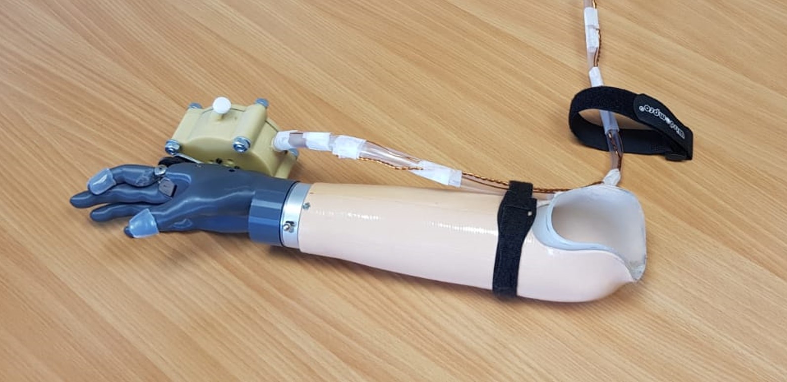 Connected prosthetic hand