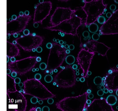 A graphic image of bubbles