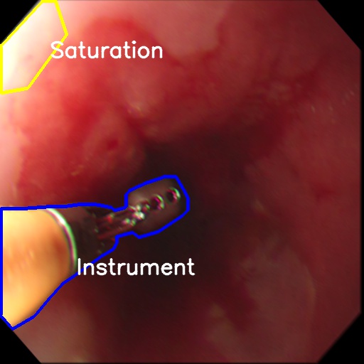 Endoscopy image with overlaid labelling of saturation and instrument