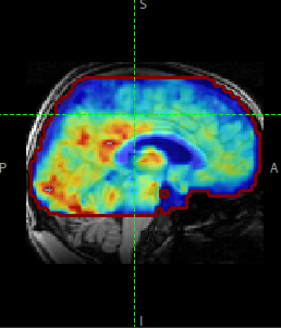 Brain ultrasound image