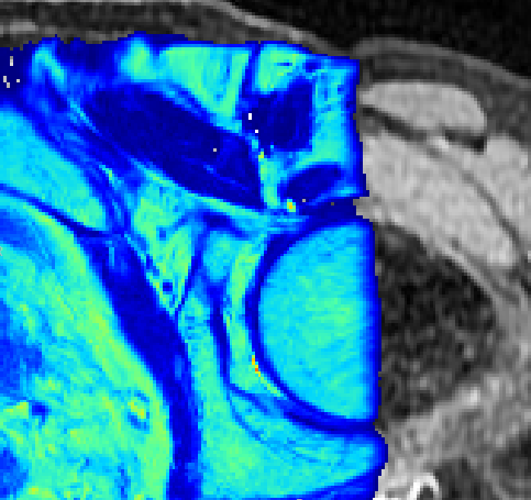 Ultrasound image