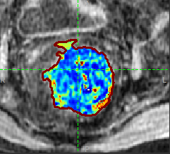 ultrasound image