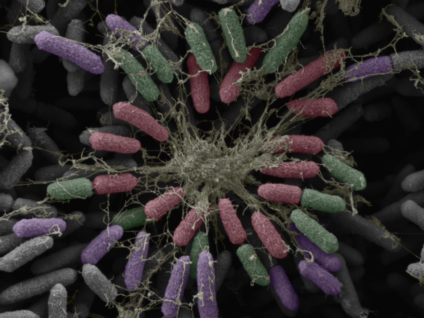 Microscopy image of bacteria and extracellular matrix fibres forming a biofilm that hinders antibiotic drug delivery.