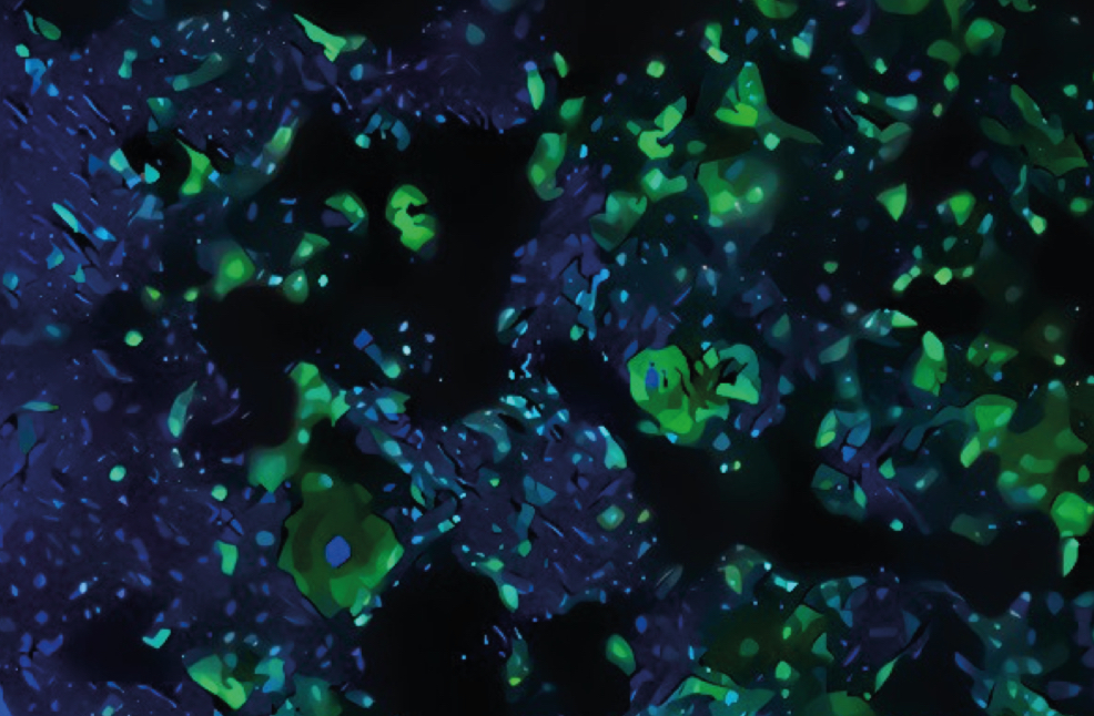 Colon cancer cells
