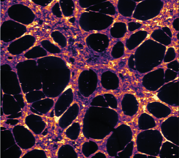 Endothelial networks single cells