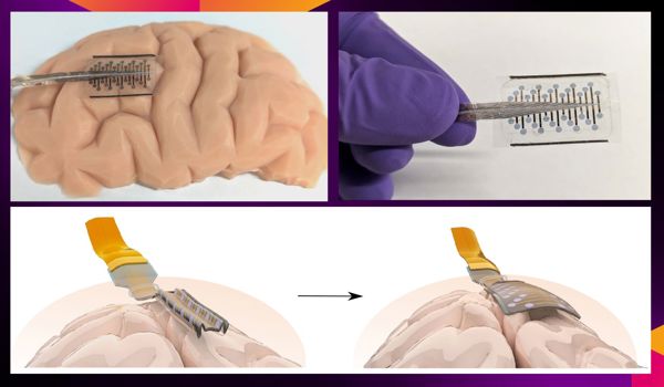 ‘Origami-inspired’ folding electrodes could reduce surgery needed to treat brain conditions