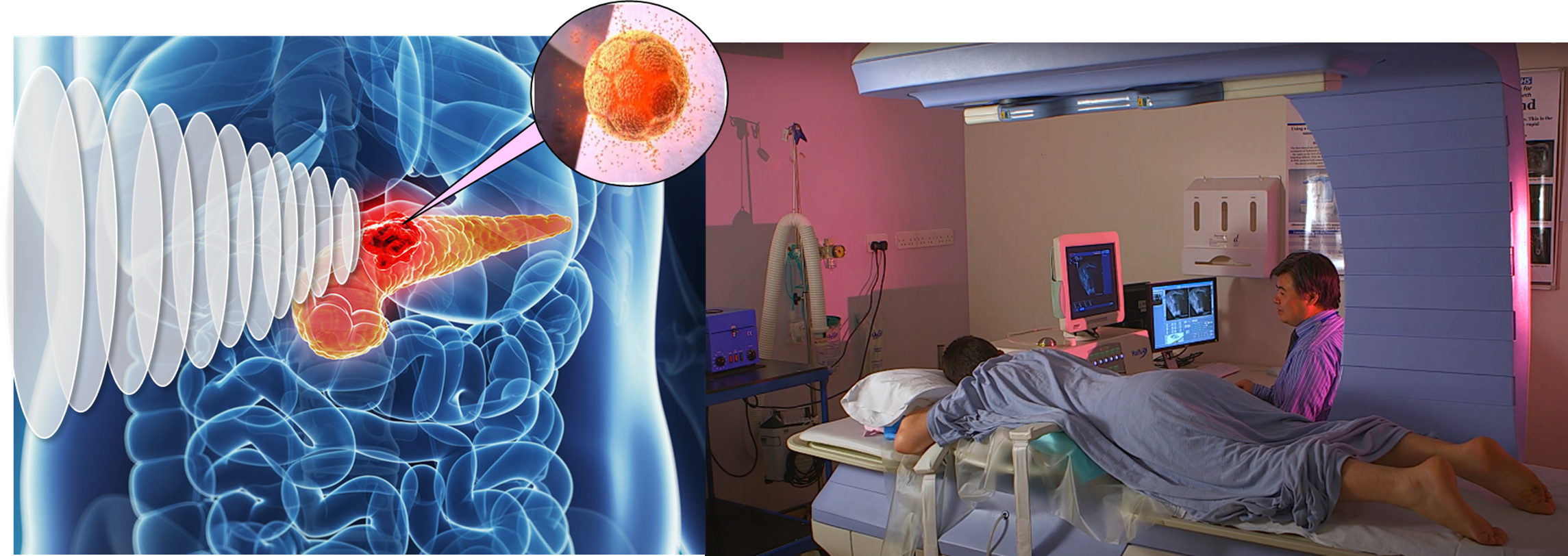 focused ultrasound in use in hospital