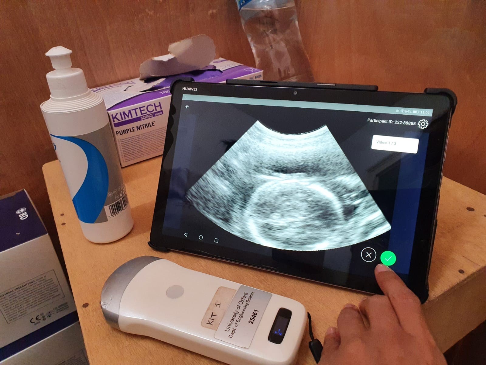 Tracer project - combines low-cost ultrasound equipment with artificial intelligence (deep learning) based image analysis algorithms