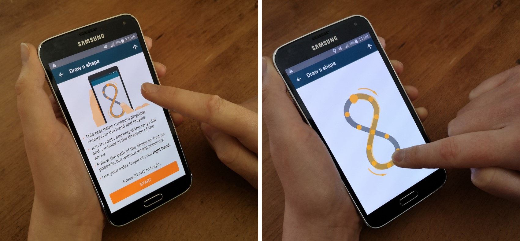 Simple smartphone-based assessments, such as a touch screen drawing test, can be used to measure disease symptoms when patients are not in the clinic