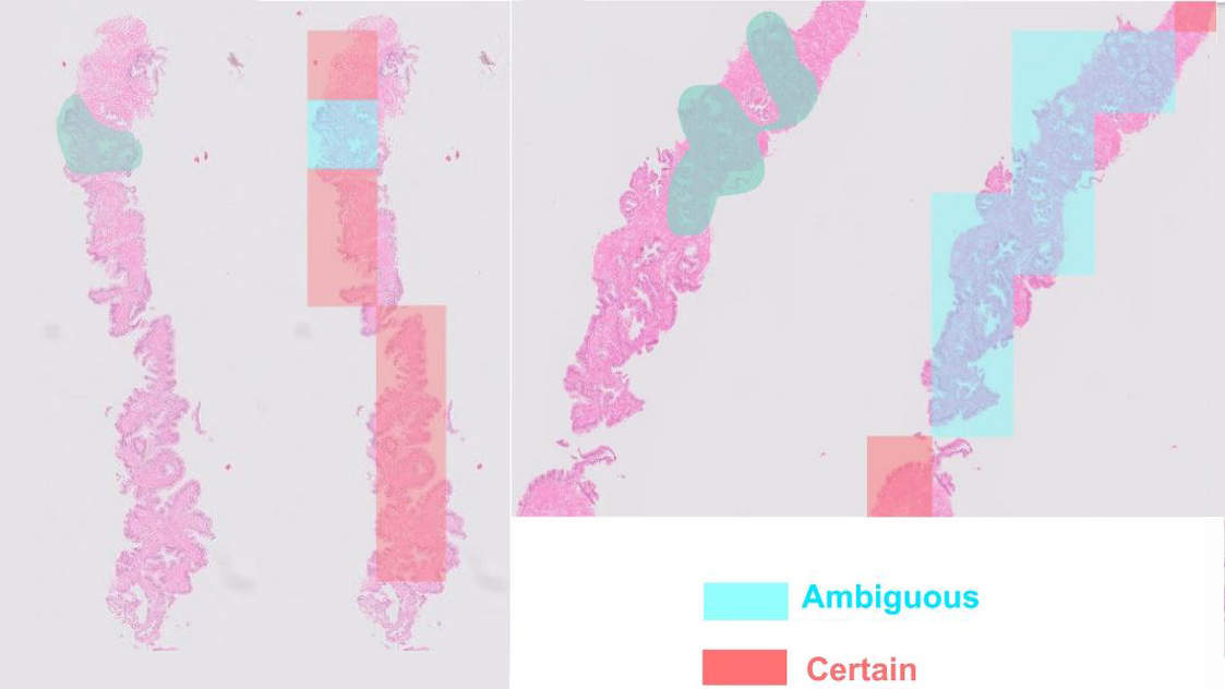 AI Pathology Image