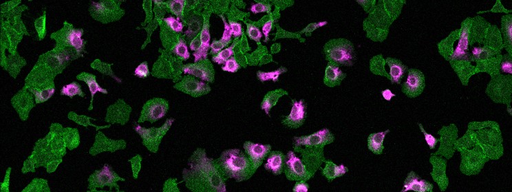 Cells exposed to ultrasound