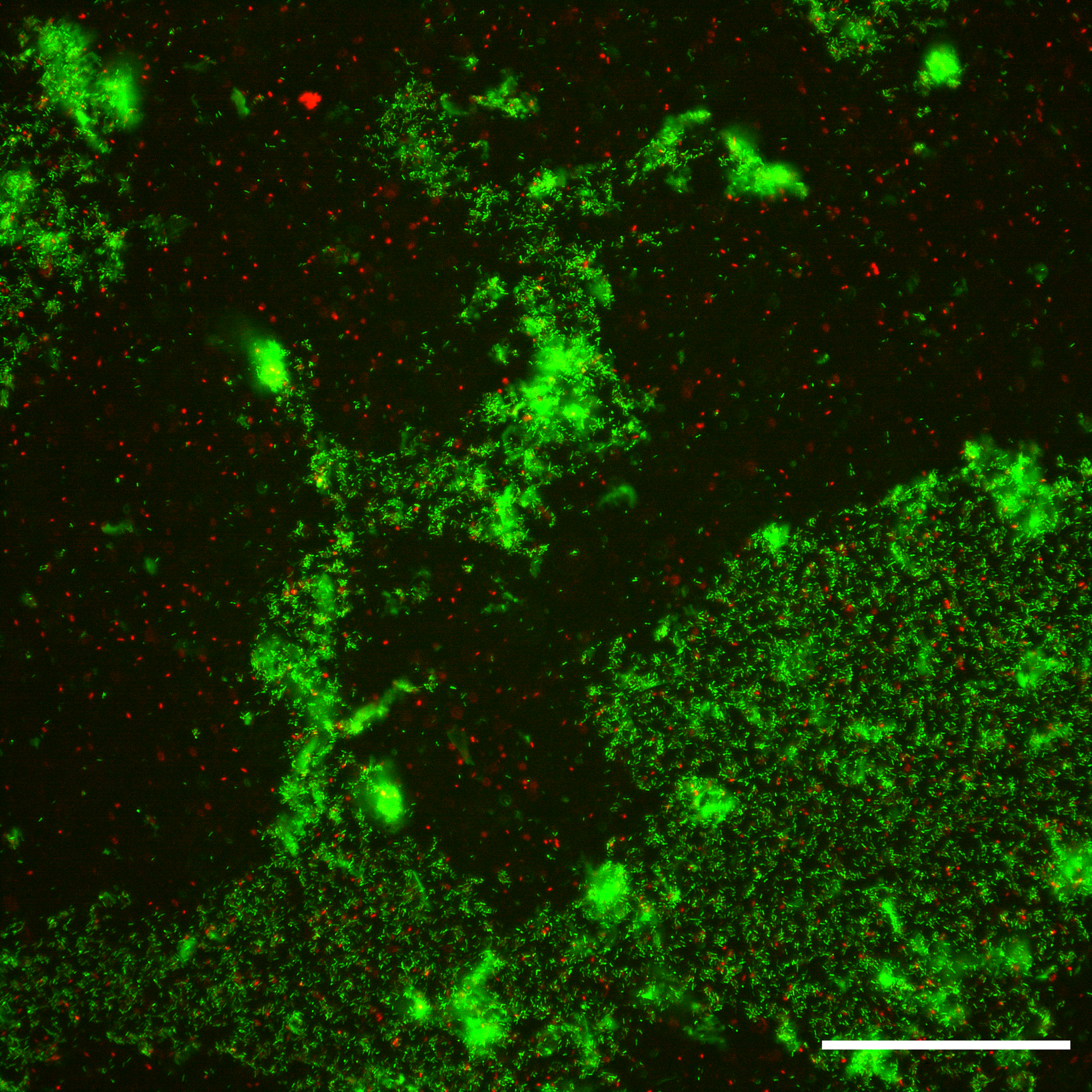 Biofilm reduction following ultrasound exposure