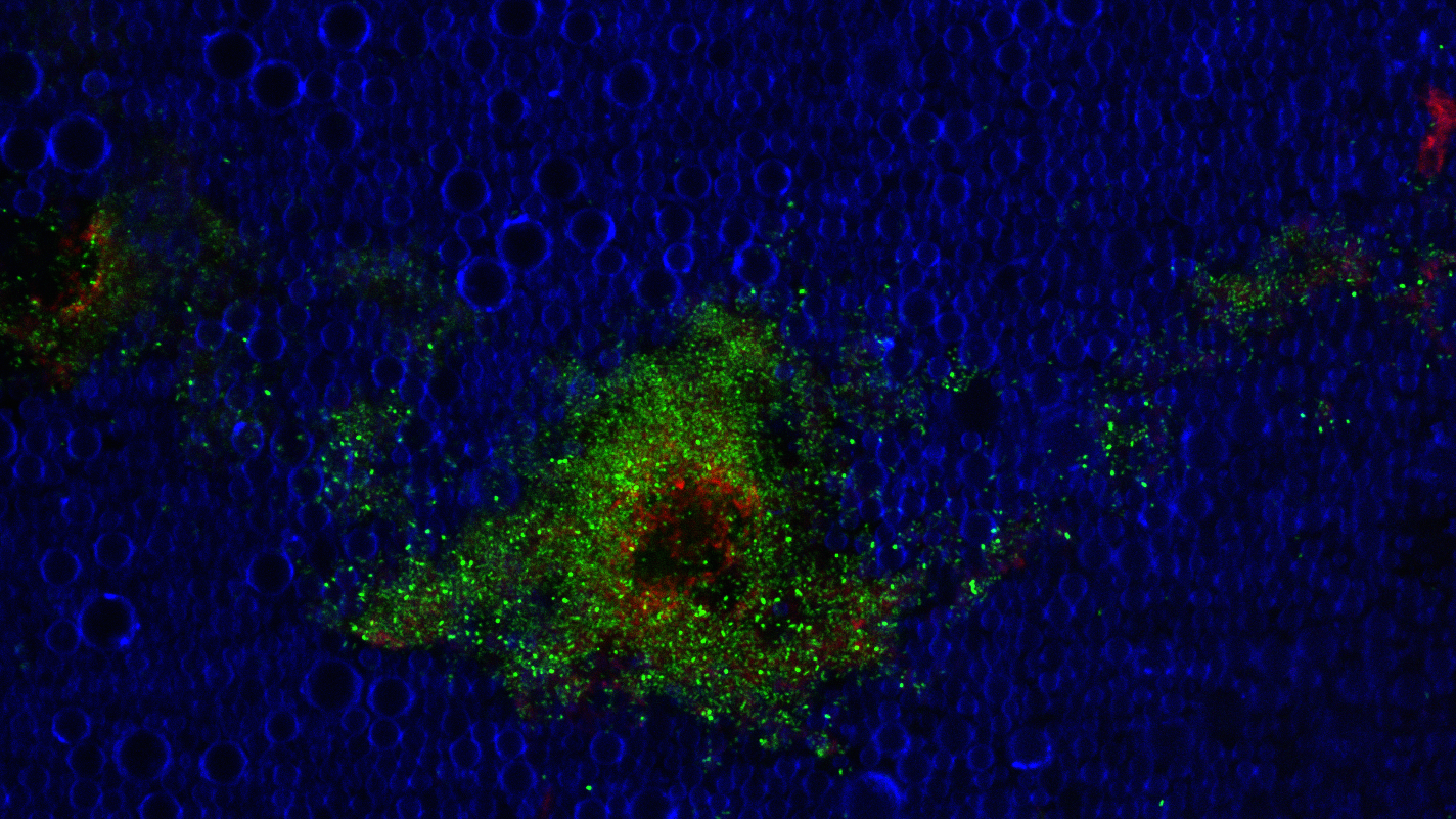 Micro-and nanoencapsulation of antibiotics